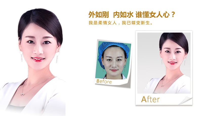 海北V脸、线雕隆鼻